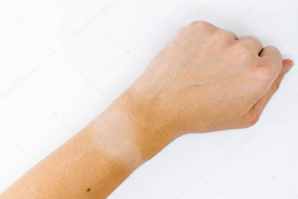 Hand with sun burn left the mark on wrist watch on white background