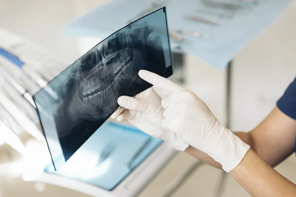 Doctor talking with her patient and teaching a radiograph. — Stock Photo, Image