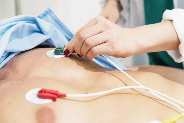 ECG electrodes on the patient — Stock Photo, Image