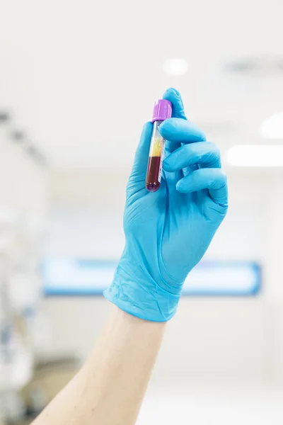 Hand holding blood in test tube — Stock Photo, Image