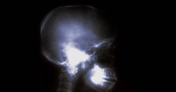 Ray Human Bones Flashing Series — Vídeo de Stock