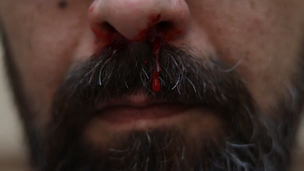 Egy Szakállas Férfinak Vér Folyik Orrából Egy Csepp Vér Folyik — Stock videók