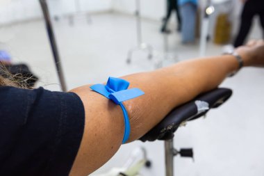 Kolları mavi turnike ile klinik bir ortamda kan toplanması için hazırlandı. Sağlık, kan bağışı, laboratuvar testleri ve tıbbi bakım kavramı