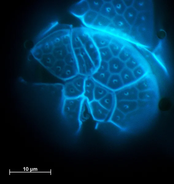 Мікроскоп вигляд комірки — стокове фото