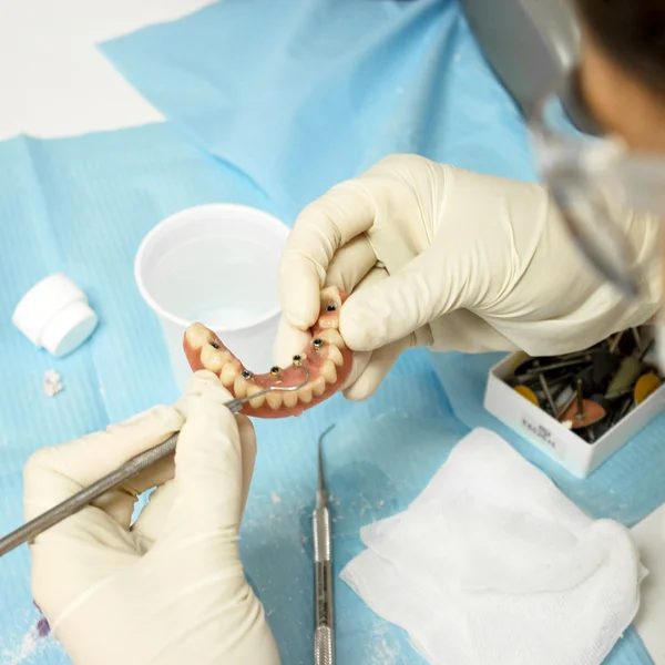 Clínica dental trabajando en prótesis dentales — Foto de Stock