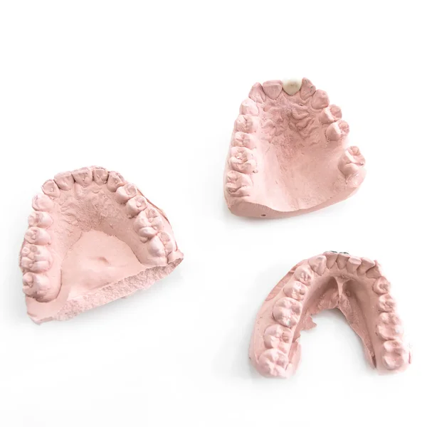 Prótesis dental aislada en blanco — Foto de Stock