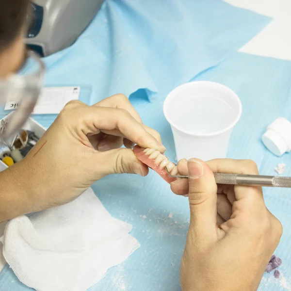 Clínica odontológica mãos trabalhando na dentadura — Fotografia de Stock