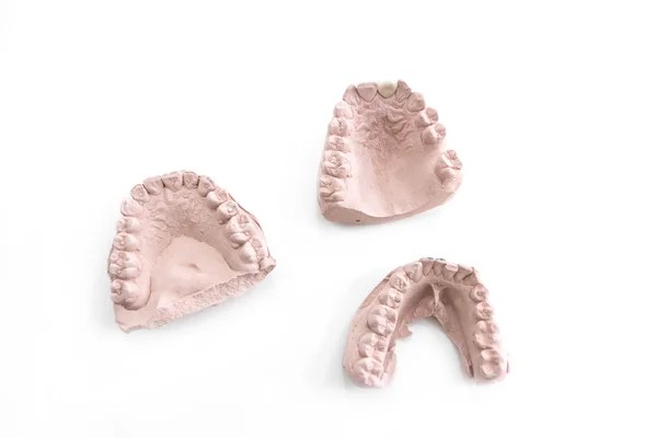 Modelo de dentadura em clínica odontológica — Fotografia de Stock