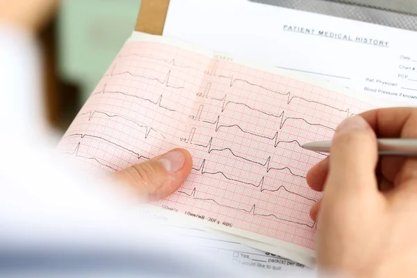 Férfi gyógyszer orvos kéz gazdaság cardiogram chart — Stock Fotó