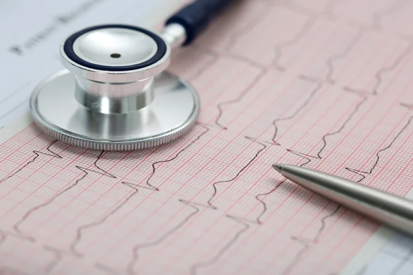 Sztetoszkóp fej és ezüst toll cardiogram feküdt — Stock Fotó