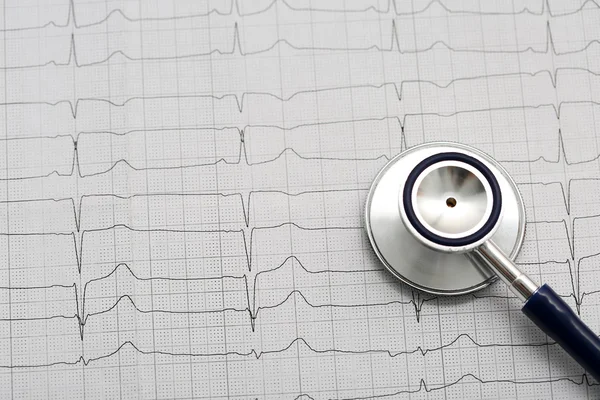 Cabeza del estetoscopio acostada en el cardiograma en el portapapeles —  Fotos de Stock
