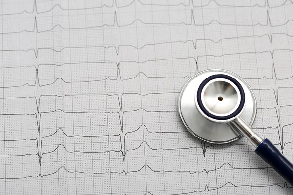 Sztetoszkóp fej feküdt cardiogram vágólap pad — Stock Fotó