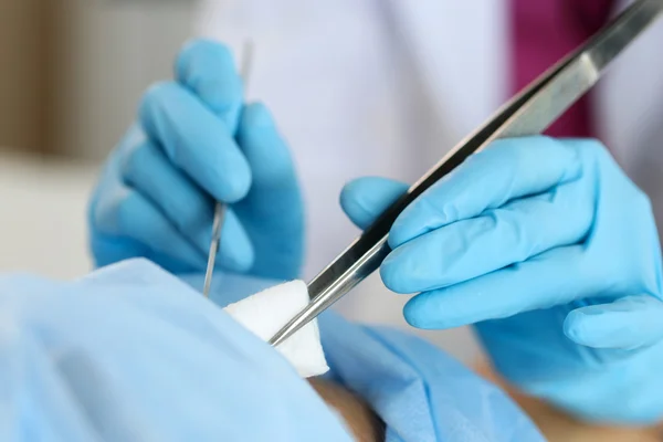 Surgeon hand hold scalpel and tweezers — Stock Photo, Image