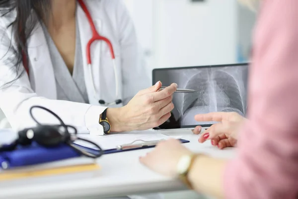 Doktor ukazuje pacientovi rentgen plic. — Stock fotografie