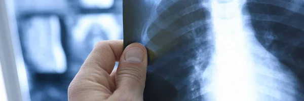 Los médicos sostienen rayos X de los pulmones en el consultorio médico. — Foto de Stock