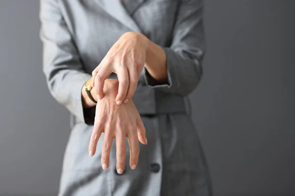 Жінка в сірому платті подряпає руки крупним планом — стокове фото