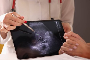 Doktor dijital tablette tükenmez kalemle ultrasonun fotoğrafını gösteriyor.
