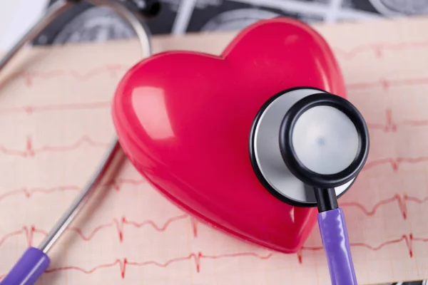 On table lies cardiogram heart and stethoscope — Stock Photo, Image