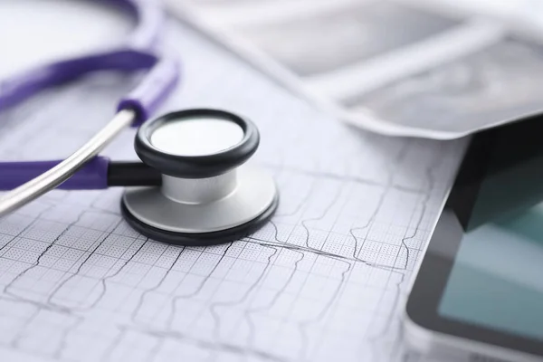 There is cardiogram tablet and stethoscope on table — Stock Photo, Image