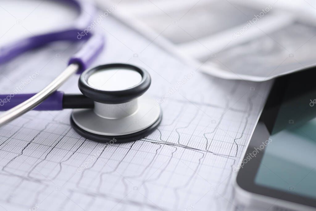 There is cardiogram tablet and stethoscope on table