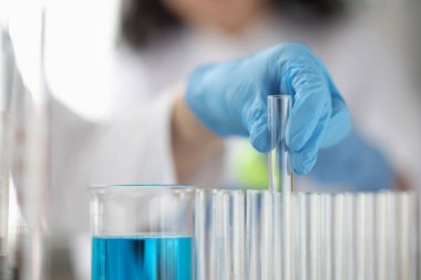 Eldivenli el tıbbi test tüpünü çıkarır.