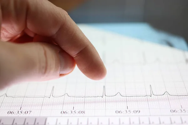 Pulgar sobre la tableta con imagen de cardiograma cardíaco —  Fotos de Stock