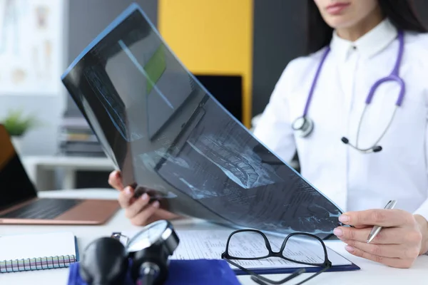 Žena lékař držení rentgen v rukou v klinice detailní záběr — Stock fotografie