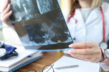 Doktor muayenehanedeki hastanın röntgenini inceliyor.