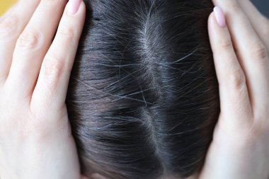 Closeup of gray hair on woman head