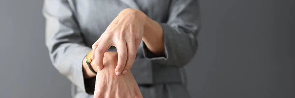 Vrouw in grijs jurk krabben haar handen close-up — Stockfoto