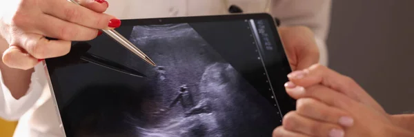 Doktor zobrazující fotografii ultrazvuku s kuličkovým perem na digitálním tabletu detailně — Stock fotografie