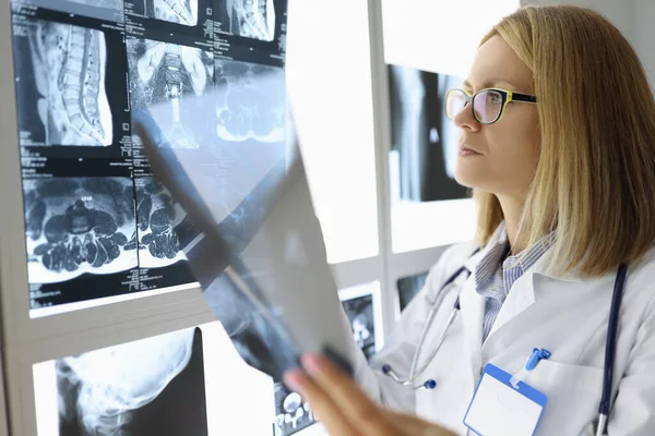 Medico donna esamina una radiografia in studio medico. — Foto Stock