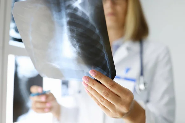 Las manos de los médicos sostienen una radiografía en el consultorio médico. — Foto de Stock