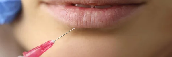 Esteticista médico fazendo injeção de pacientes lábios close-up — Fotografia de Stock