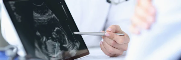 Il medico dimostra l'ecografia fetale sullo schermo del tablet — Foto Stock