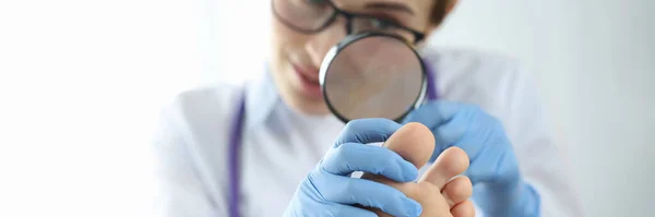 Dermatologis memeriksa kuku kaki dengan kaca pembesar closeup — Stok Foto