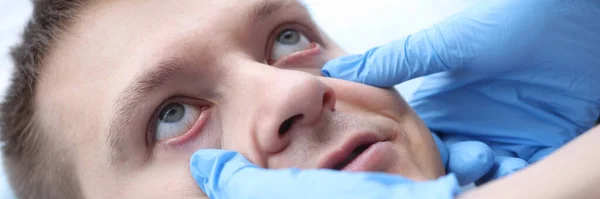 患者の眼の粘膜を調べる手袋を持つ医師 — ストック写真