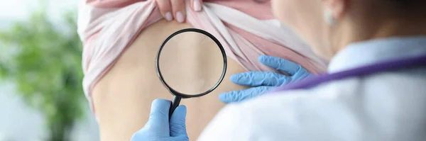 Dokter onderzoekt huid op rug van vrouwelijke patiënt met behulp van vergrootglas — Stockfoto