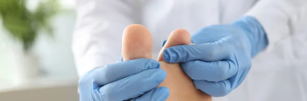 Gloved doctor examines patients skin on leg between toes