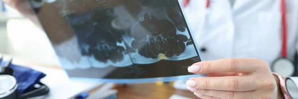 El médico examina una radiografía del paciente en el consultorio médico — Foto de Stock