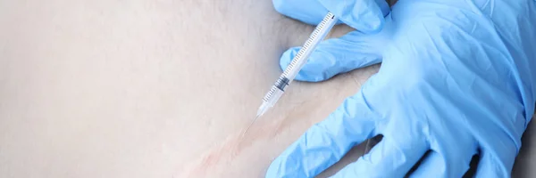 Verpleegkundige injecterend geneesmiddel bij patiënten postoperatief litteken close-up — Stockfoto