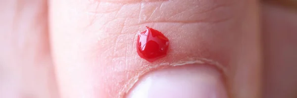 有一个手指沾满鲜血的小伤口 — 图库照片