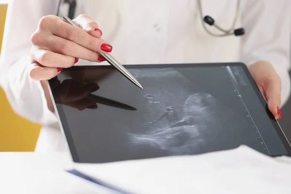 Gynekolog ukazuje ultrazvuk plodu dítěte na tabletu — Stock fotografie