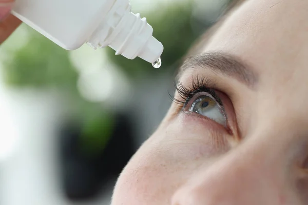 女性滴下彼女の目に抗菌ドロップクローズアップ — ストック写真