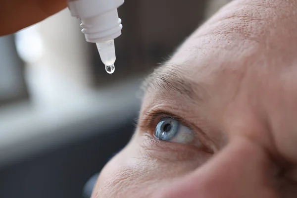 Man druppelt oogdruppels in de ogen close-up — Stockfoto