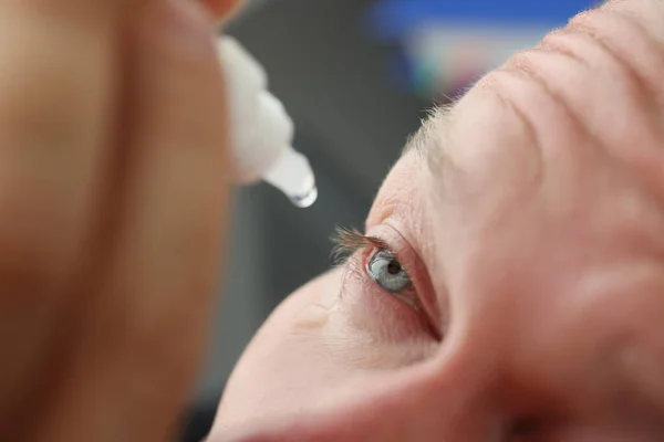 Man met huidallergie graaft medische druppels in het oog — Stockfoto