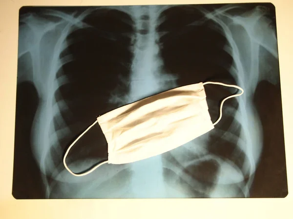 İnsan ciğerlerinin röntgeni ve beyaz tıbbi maskenin üst görüntüsü. Sağlık hizmeti kavramı.