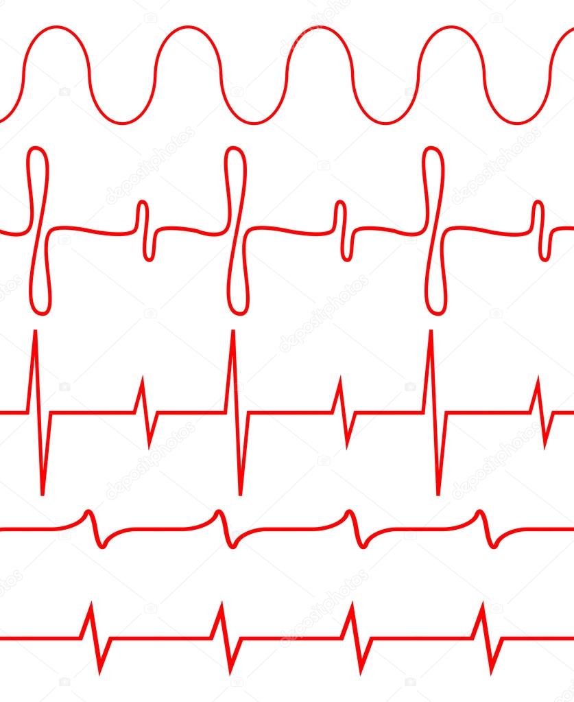 Seamless set of lines heartbeat