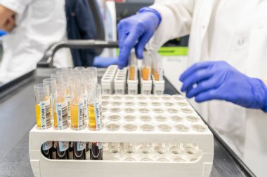 Laboratuvarda aşı için test yapan kadın. Kan çıkarma ve analitik.