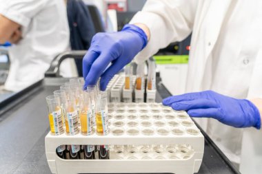 Laboratuvarda aşı için test yapan kadın. Kan çıkarma ve analitik.